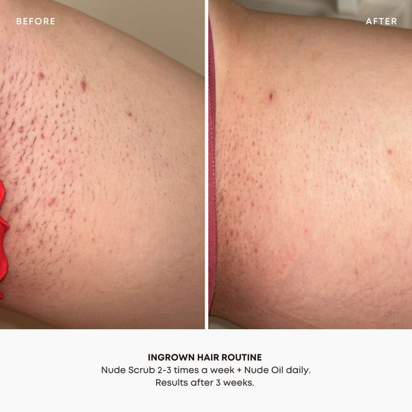Ingrown Hair Exfoliating Scrub - Nude